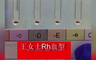 黄金血型rh黄金血型