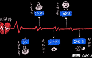 心源性猝死黄金救命时间是几分钟,心源性猝死的“黄金救命时间”是几分钟