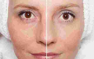 李医生暗疮水哪里有卖,李医生暗疮水