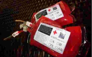 黄金血是什么血型,黄金血