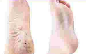 美足霜保质期美足霜