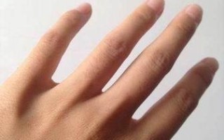 左手无名指僵硬，会有其它病的暗示吗？