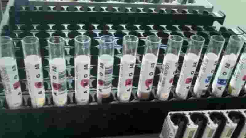 黄金血是什么血型,黄金血-第2张图片-翡翠网 黄金血是什么血型,黄金血-第2张图片-翡翠网