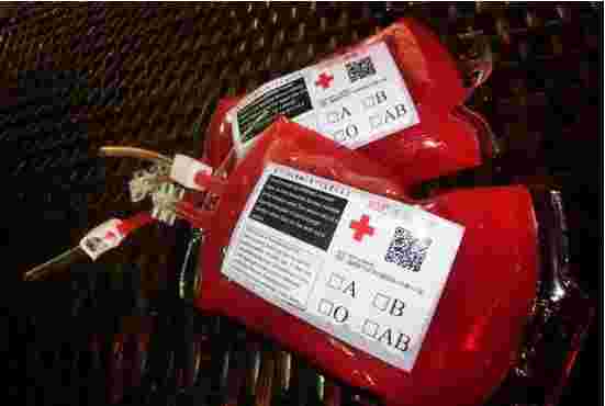 黄金血是什么血型,黄金血-第1张图片-翡翠网 黄金血是什么血型,黄金血-第1张图片-翡翠网