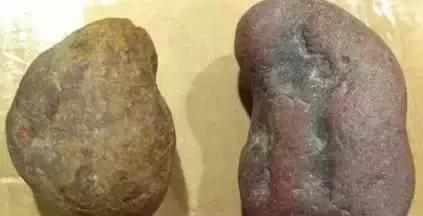 翡翠手镯发黏的简单介绍-第7张图片-翡翠网 翡翠手镯发黏的简单介绍-第7张图片-翡翠网