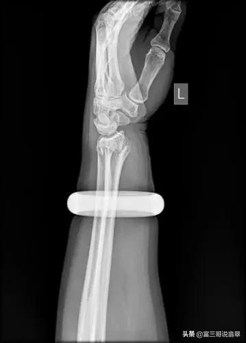 翡翠镯子有横裂纹翡翠手镯摔碎了-第5张图片-翡翠网 翡翠镯子有横裂纹翡翠手镯摔碎了-第5张图片-翡翠网