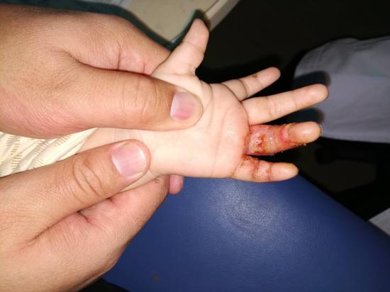 荔枝肉翡翠手镯什么价的简单介绍-第5张图片-翡翠网 荔枝肉翡翠手镯什么价的简单介绍-第5张图片-翡翠网