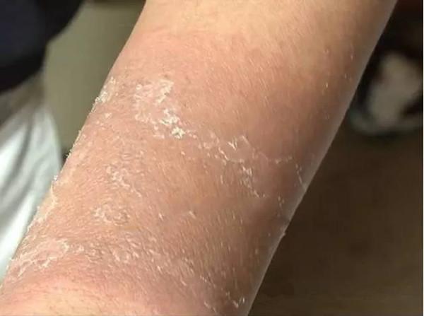 开采翡翠原石危险吗,缅甸翡翠会开采完吗-第5张图片-翡翠网 开采翡翠原石危险吗,缅甸翡翠会开采完吗-第5张图片-翡翠网