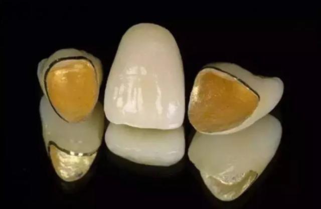 存钱好还是买金条好家庭每年存点黄金好吗-第11张图片-翡翠网 存钱好还是买金条好家庭每年存点黄金好吗-第11张图片-翡翠网