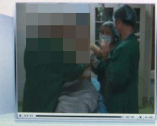 婕熹卡隆胸效果直播广东医美直播隆胸-第2张图片-翡翠网 婕熹卡隆胸效果直播广东医美直播隆胸-第2张图片-翡翠网