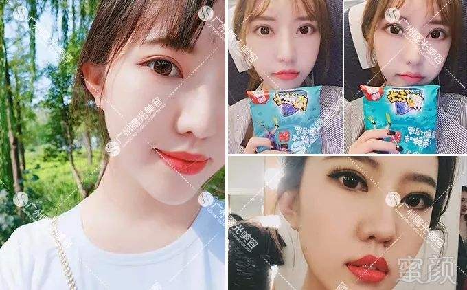 广州曙光隆胸怎么样曙光隆胸直播-第2张图片-翡翠网 广州曙光隆胸怎么样曙光隆胸直播-第2张图片-翡翠网