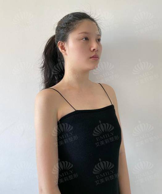 艾美整形直播隆胸艾美医疗整形脱下吊带视频-第2张图片-翡翠网 艾美整形直播隆胸艾美医疗整形脱下吊带视频-第2张图片-翡翠网