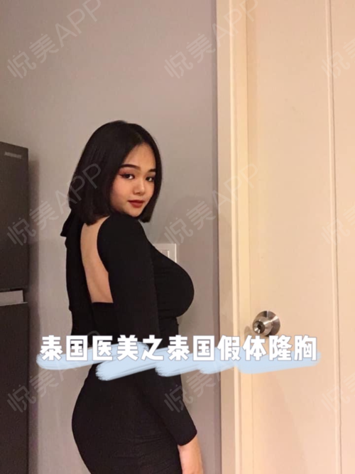 广州隆胸医院,广东隆胸效果直播-第2张图片-翡翠网 广州隆胸医院,广东隆胸效果直播-第2张图片-翡翠网