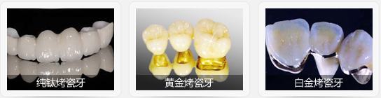 黄金烤瓷牙,黄金烤瓷牙图片-第1张图片-翡翠网 黄金烤瓷牙,黄金烤瓷牙图片-第1张图片-翡翠网