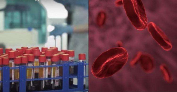 江苏发现2例罕见黄金血型的简单介绍-第2张图片-翡翠网